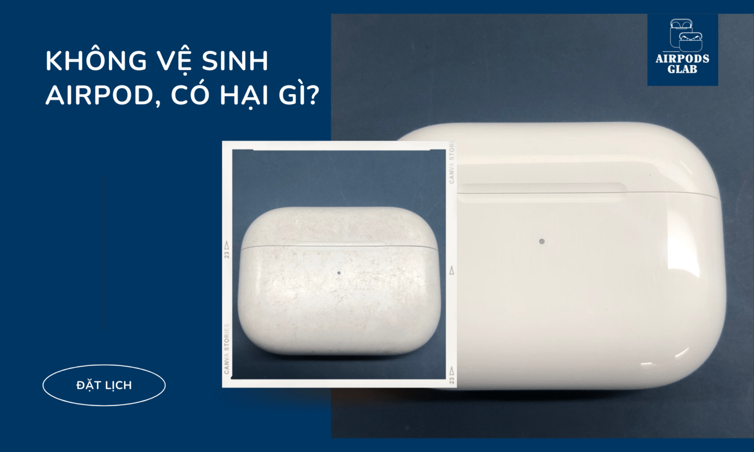 Dùng Tai Nghe Airpod Lâu Ngày Không Vệ Sinh, Có Hại Gì?