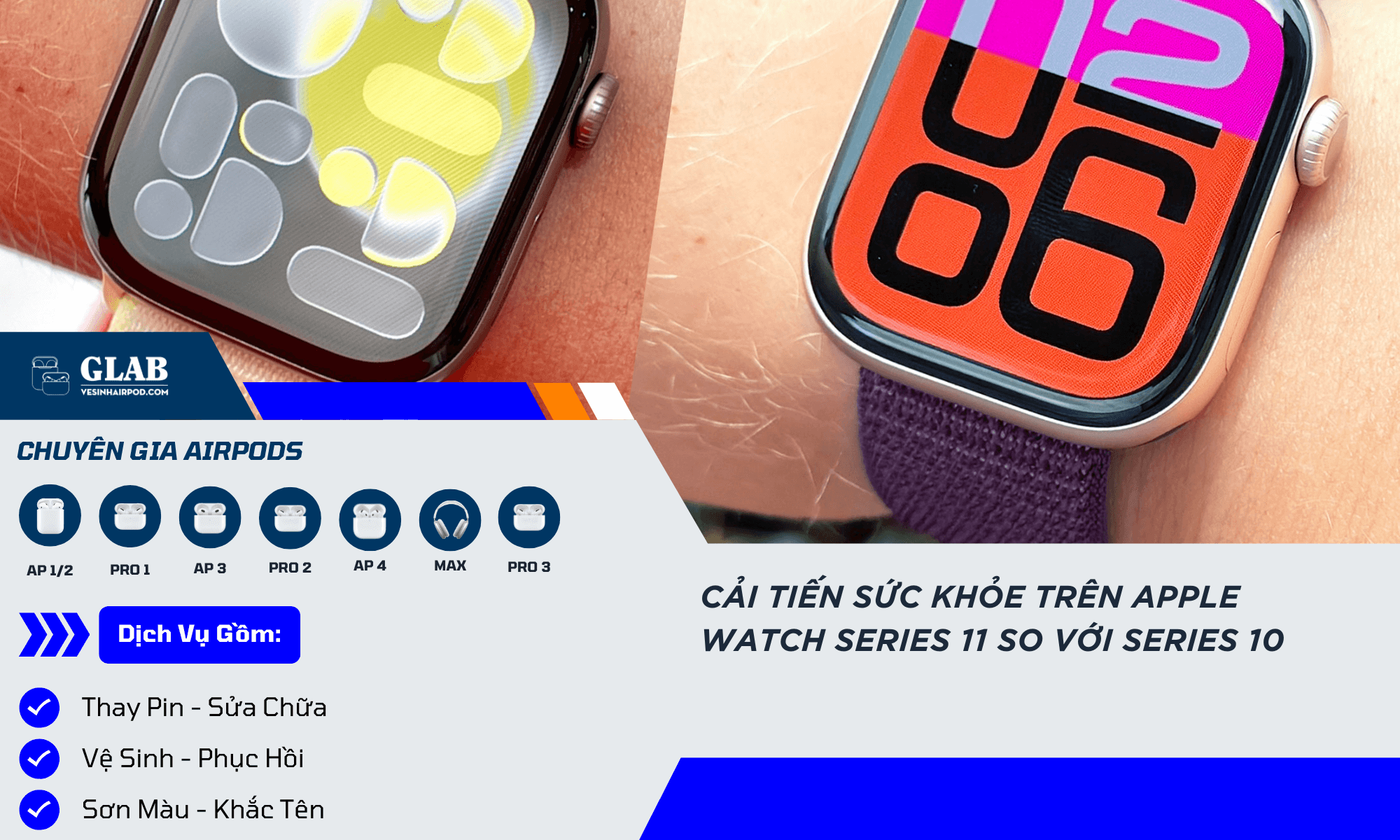 apple-watch-series-11-so-voi-series-10-00003